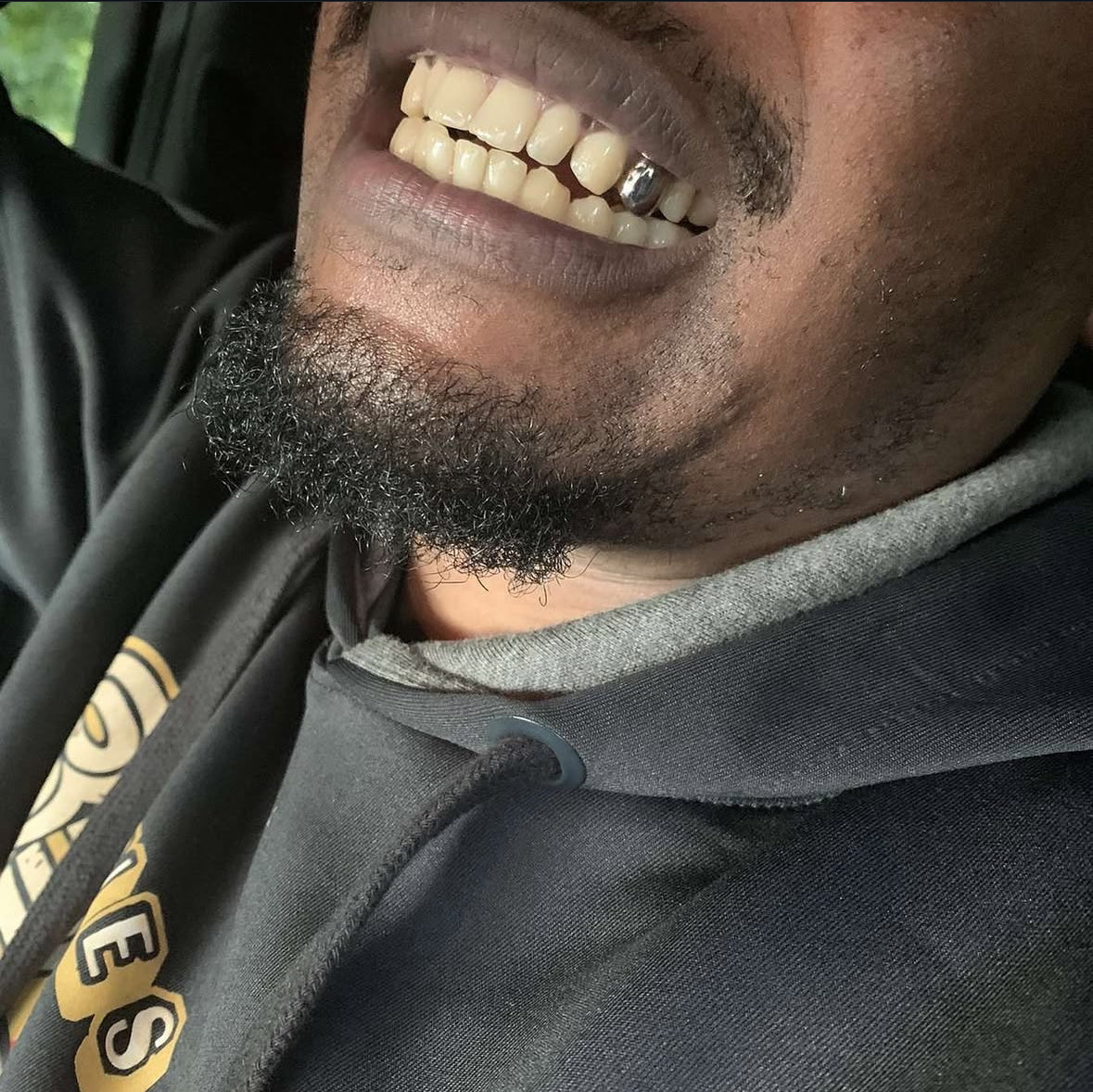 DENTAL SILVER GRILLZ