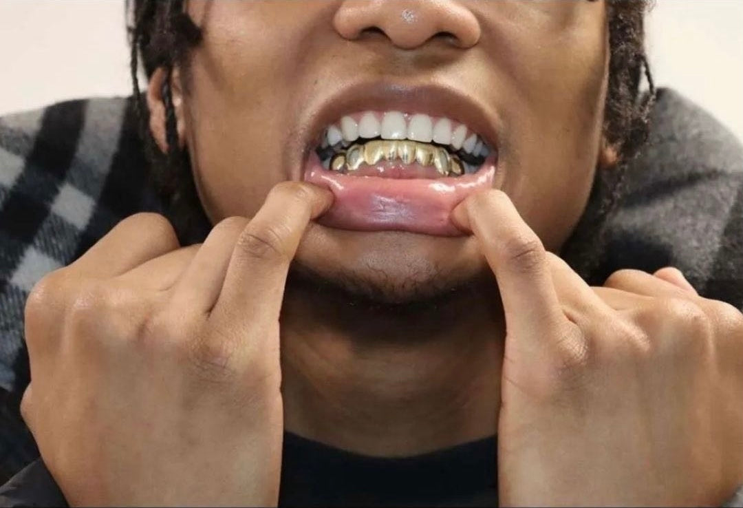 DENTAL GOLD GRILLZ