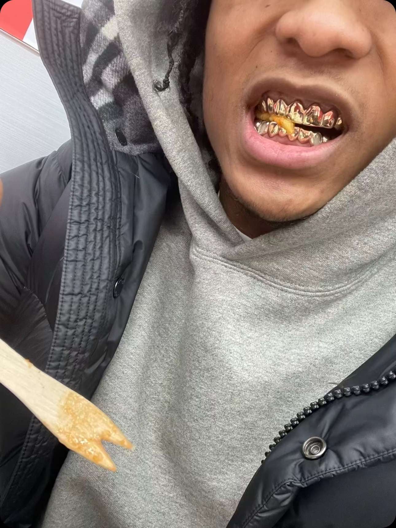 GOLD GRILLZ