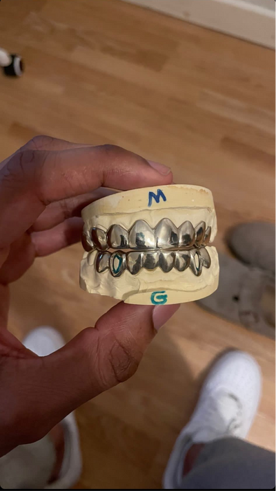 DENTAL GOLD GRILLZ