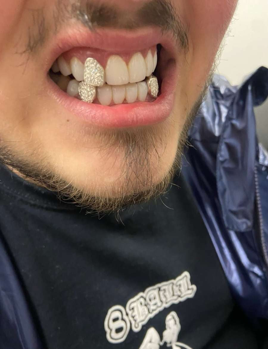 VVS DIAMOND GRILLZ ON DENTAL SILVER