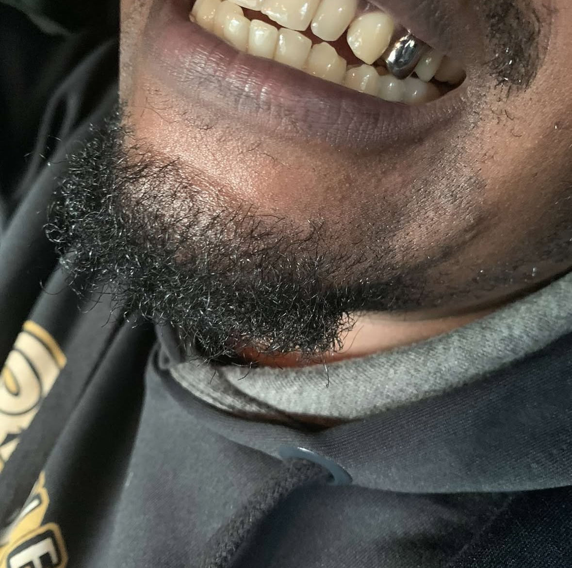 DENTAL SILVER GRILLZ